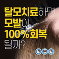 [홍성재 탈모 칼럼] 탈모 치료하면 모발이 100% 회복될까?